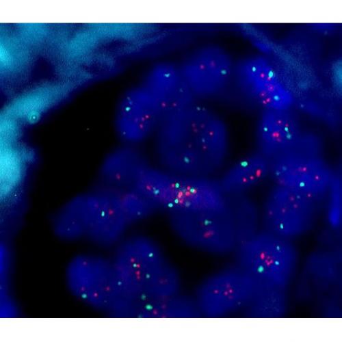 Fluorescence in Situ Hybridization (FISH) CancerQuest